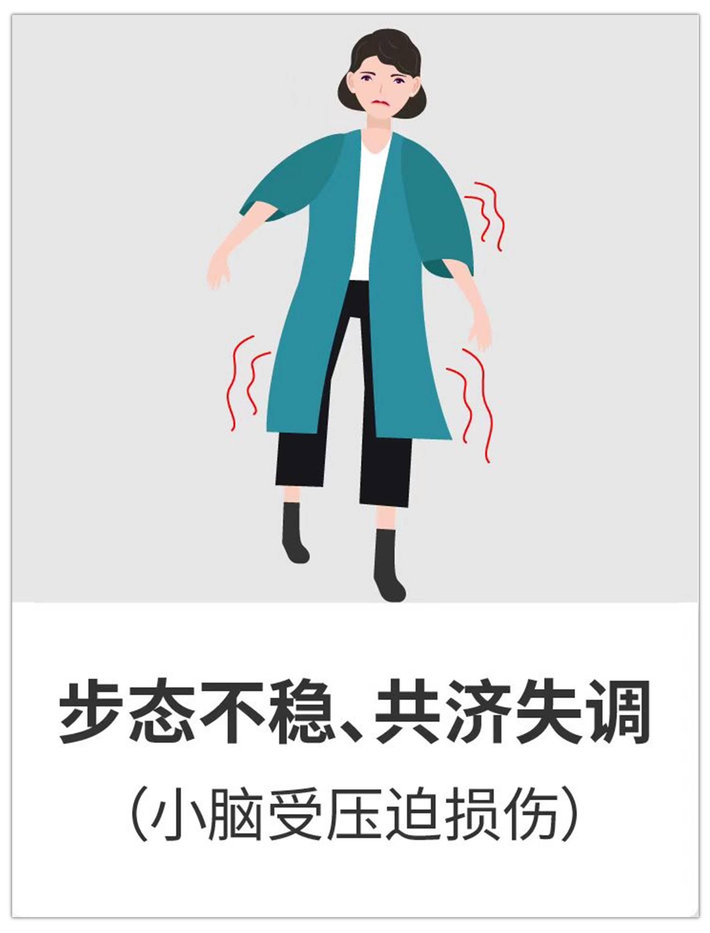 聽(tīng)神經(jīng)瘤進(jìn)展會(huì)出現(xiàn)哪9大癥狀？治療后都能恢復(fù)嗎？手術(shù)關(guān)鍵是什么？