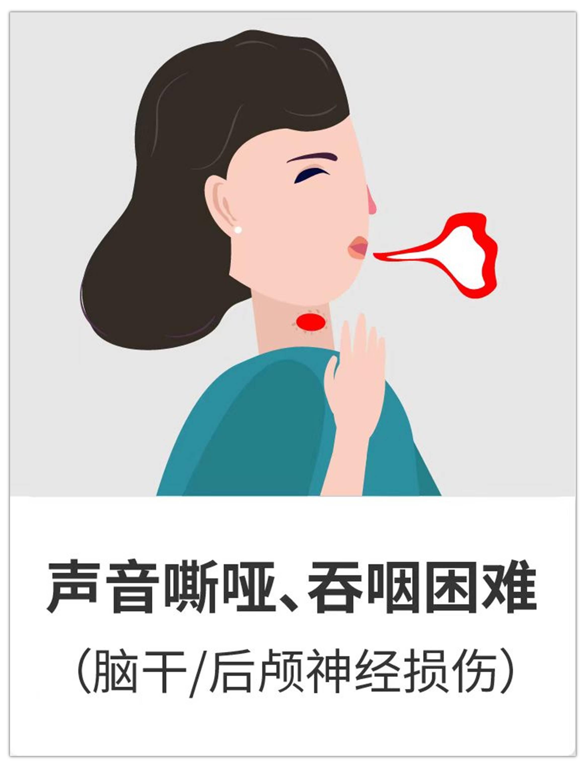 聽(tīng)神經(jīng)瘤進(jìn)展會(huì)出現(xiàn)哪9大癥狀？治療后都能恢復(fù)嗎？手術(shù)關(guān)鍵是什么？