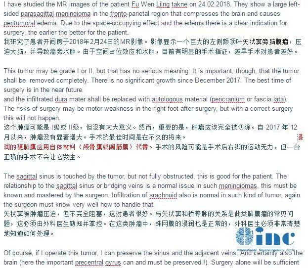 較大腦膜瘤長在大靜脈竇、大腦鐮旁能治愈嗎，復(fù)雜腦膜瘤的治療策略