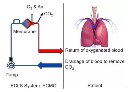一線生機(jī)、不放棄，心跳驟停后ECMO“硬核”技術(shù)屢創(chuàng)奇跡