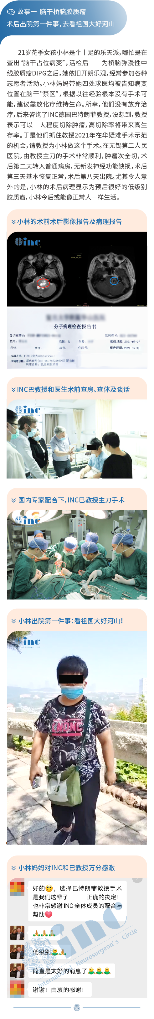 腦干橋腦膠質(zhì)瘤