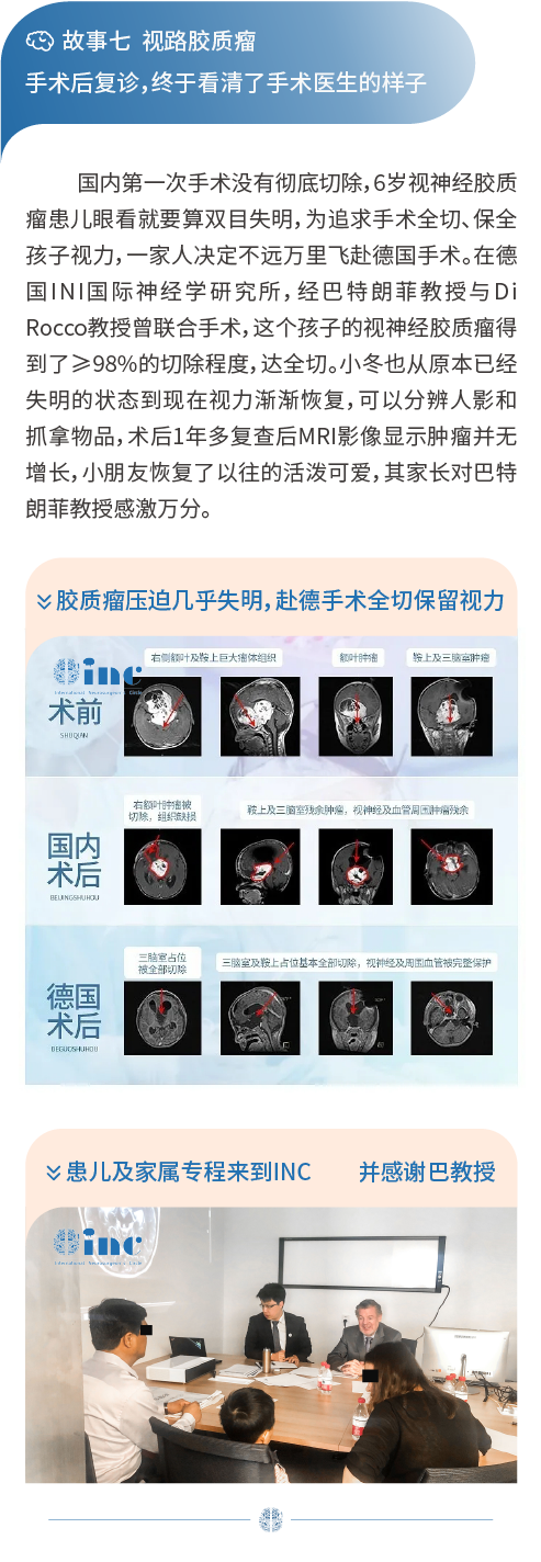 視路膠質(zhì)瘤
