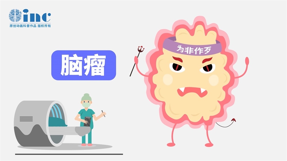 脊髓毛細胞星形細胞瘤