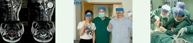 INC成功手術(shù)案例之脊髓髓內(nèi)腫瘤可能癱瘓的他，全切術(shù)后沒有復(fù)發(fā)、行走自如！