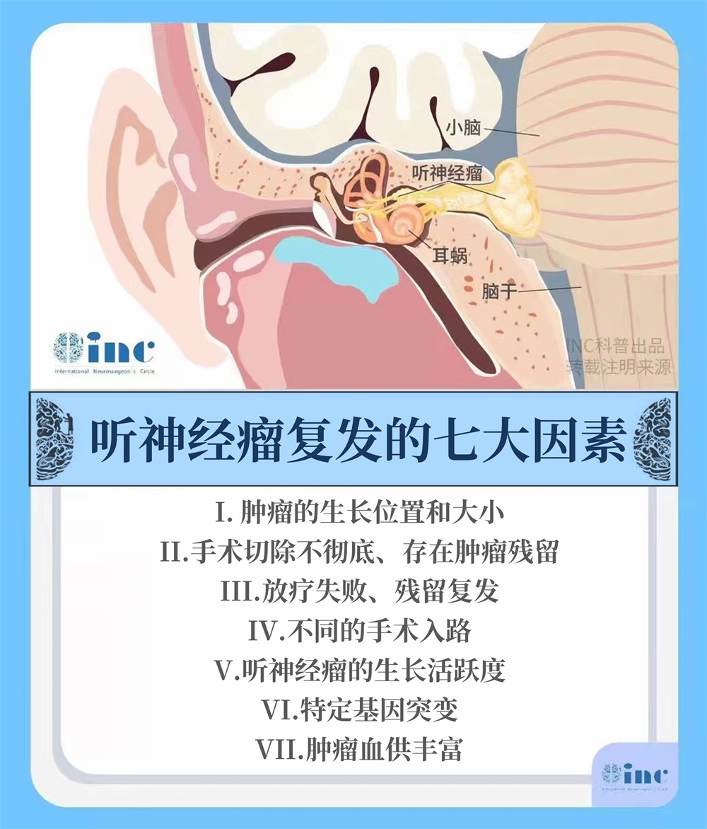 聽神經(jīng)瘤