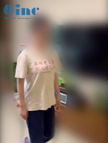 丘腦海綿狀血管瘤手術(shù)案例——預后
