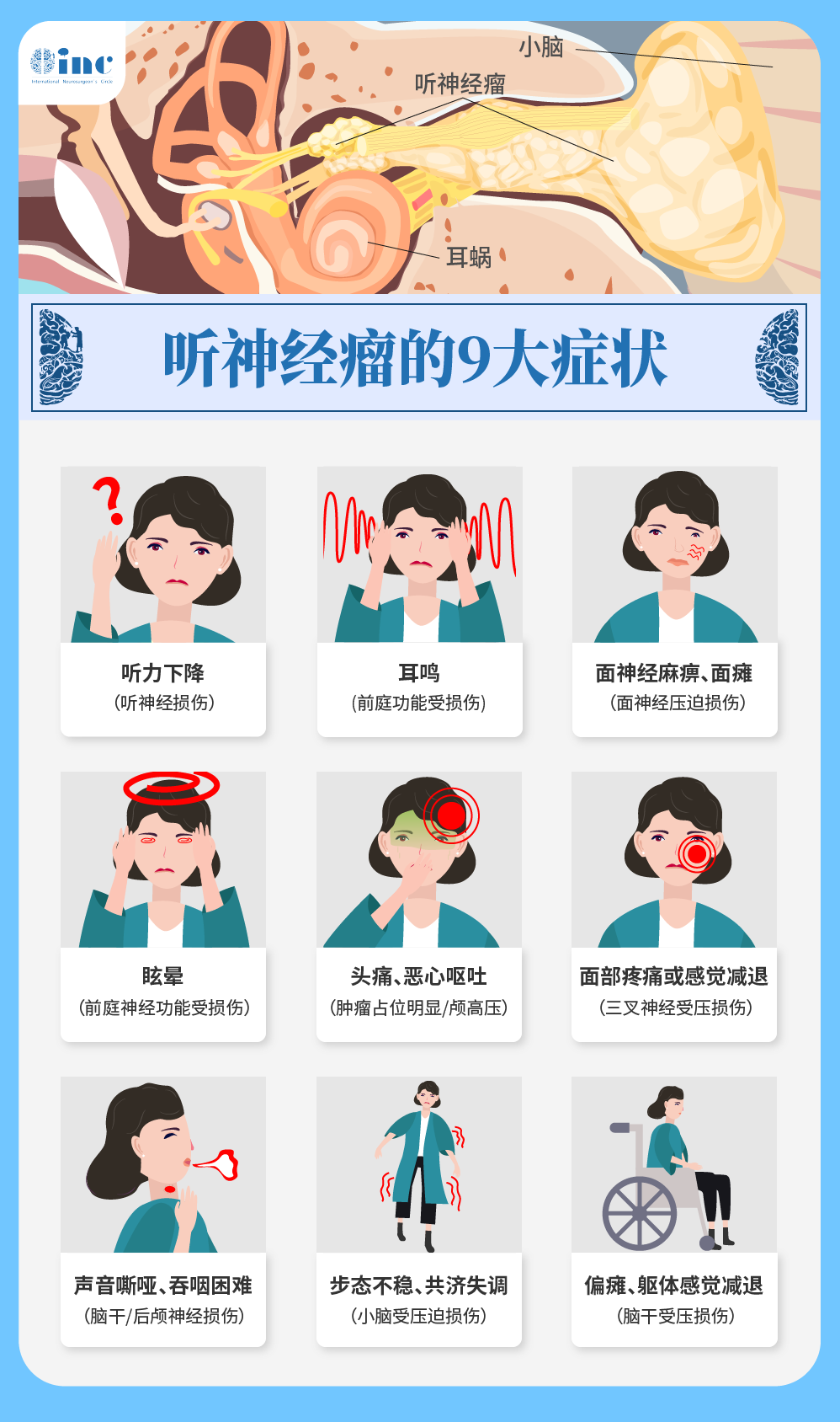 突發(fā)耳聾耳鳴也要警惕聽(tīng)神經(jīng)瘤
