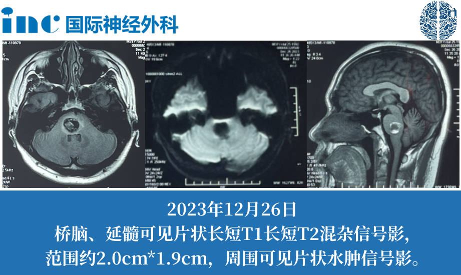 術(shù)前影像