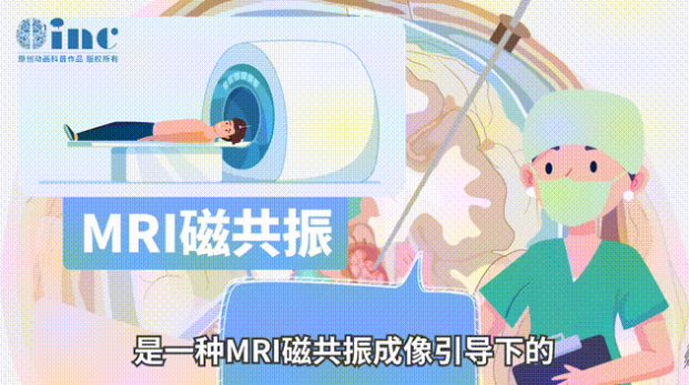 激光間質(zhì)熱療（LITT），是一種MRI磁共振成像引導(dǎo)下的微創(chuàng)外科手術(shù)。