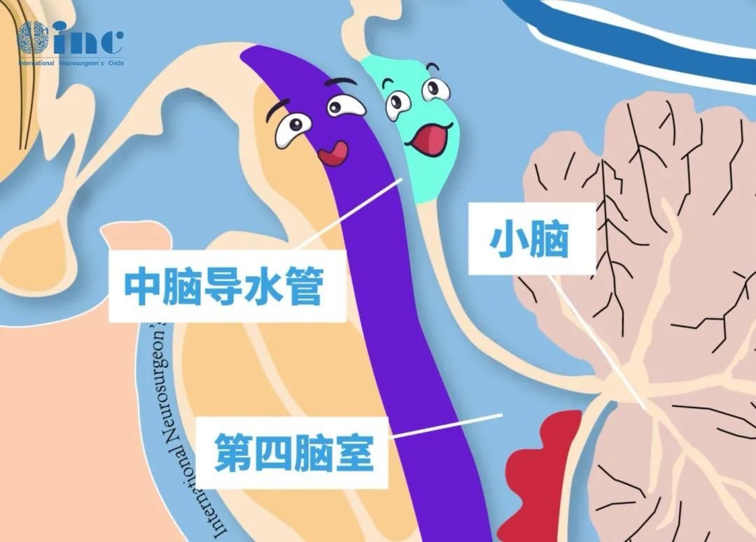 中腦頂蓋位置示意圖，藍(lán)色部分為頂蓋