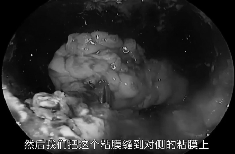 這個小切口有什么好處？