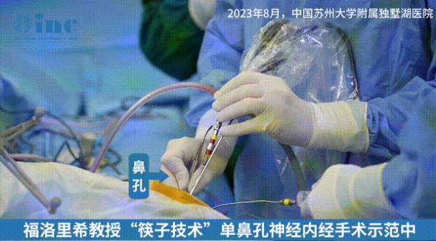 兒童鼻內(nèi)鏡手術(shù)比成人更難，為何？