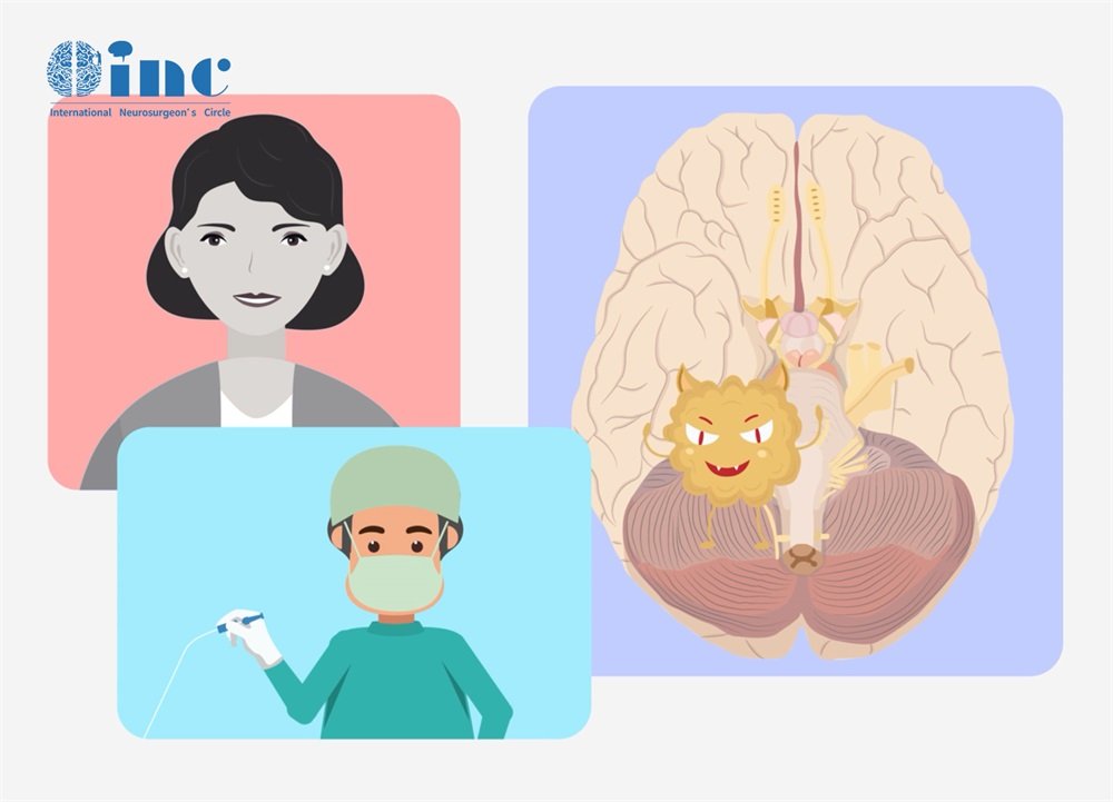 脊髓膠質(zhì)瘤4級帶瘤生存？