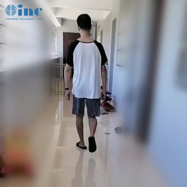 34歲男性-腦干延髓-頸髓室管膜瘤WHO2級(jí)案例術(shù)后圖片
