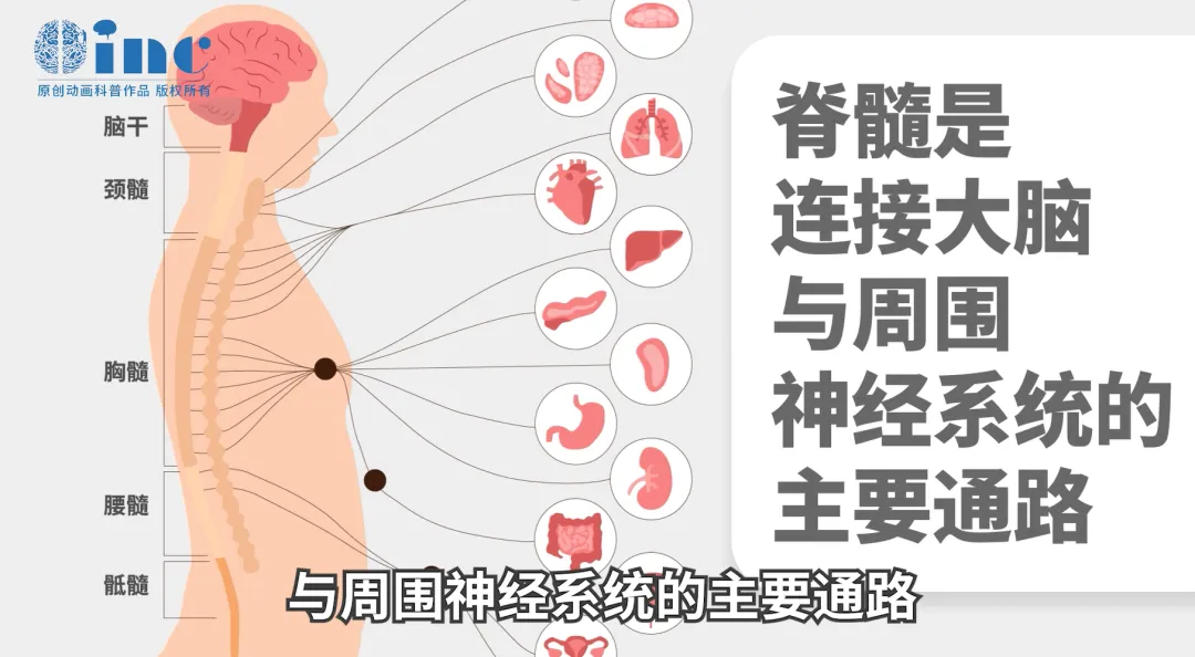 脊髓海綿狀血管瘤圖片