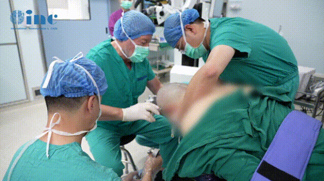 手術(shù)開始前，巴教授親自安裝頭架并為患者固定上頭架