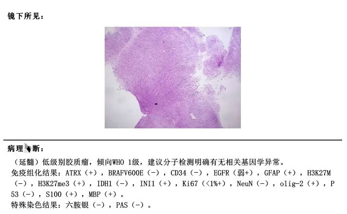 病理結(jié)果