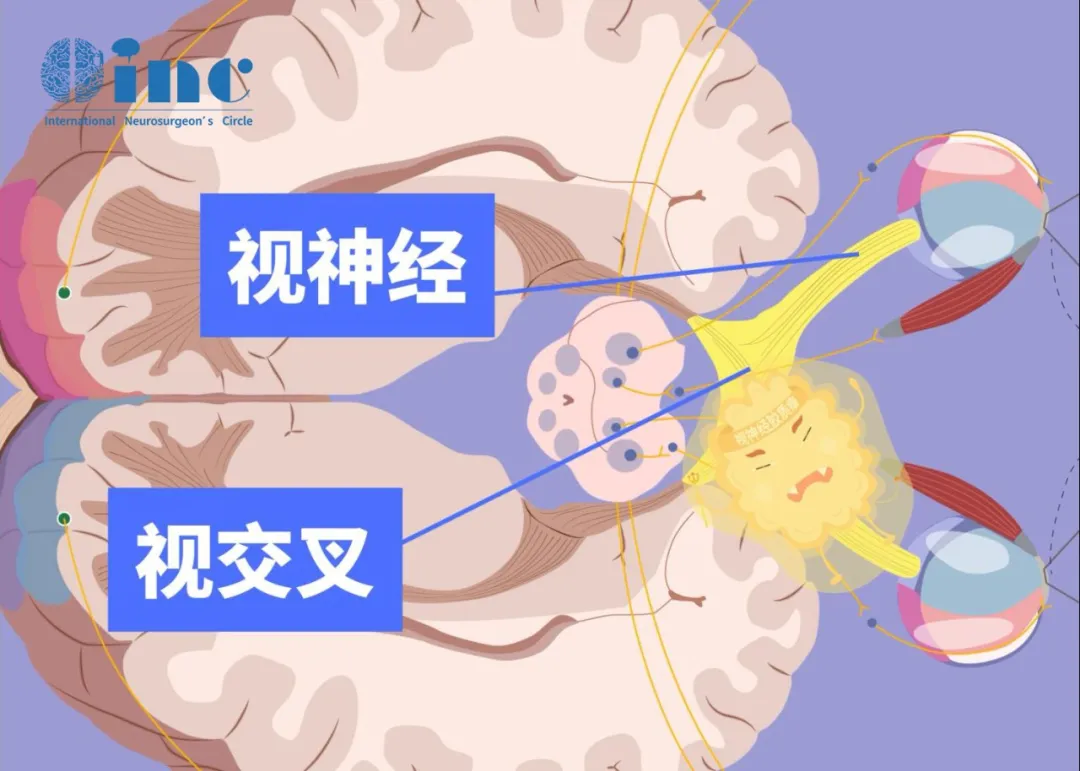 視神經(jīng)、視交叉圖片