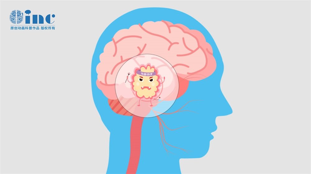 小腦海綿狀血管瘤片子怎么看?