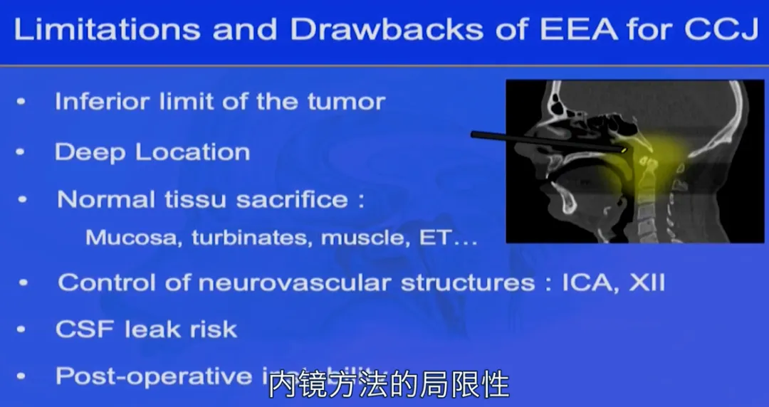 經(jīng)鼻內(nèi)鏡手術(shù)可能帶來哪些后遺癥