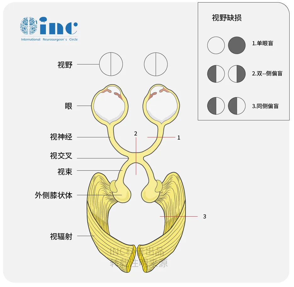 視神經(jīng)科普圖片