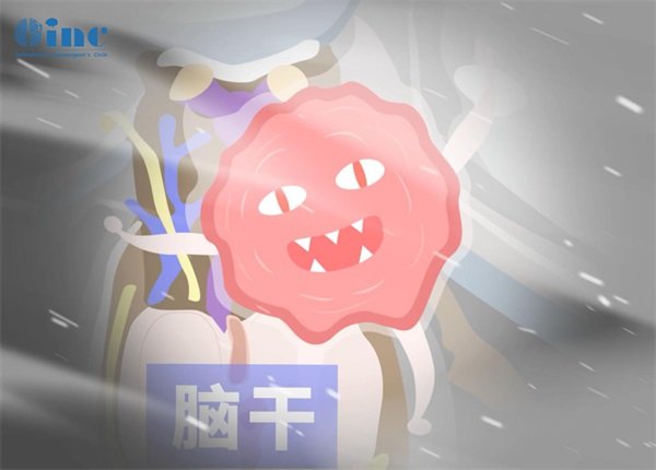 腦干膠質(zhì)瘤2毫米能治好嗎?手術(shù)切得干凈嗎?