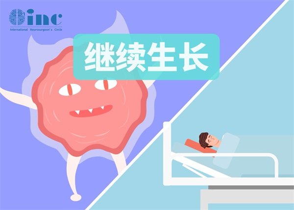 顱內(nèi)軟骨肉瘤生長有多快?