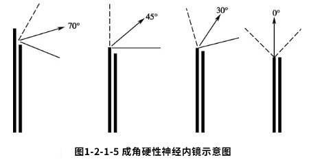 神經(jīng)內(nèi)鏡