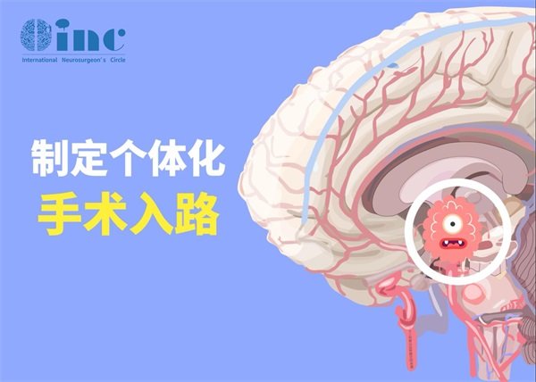 顱咽管瘤手術應該開顱還是經(jīng)鼻?
