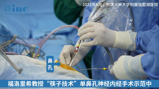 福教授經(jīng)鼻神經(jīng)內(nèi)鏡手術(shù)