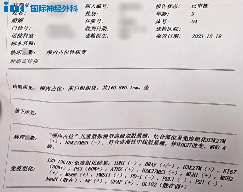 立體定向活檢，病理結(jié)果顯示如下：兒童彌漫性中線膠質(zhì)，伴H3K27改變，WHO4 級。鑒于其30%的高Ki67指數(shù)，其生長速度相當快。