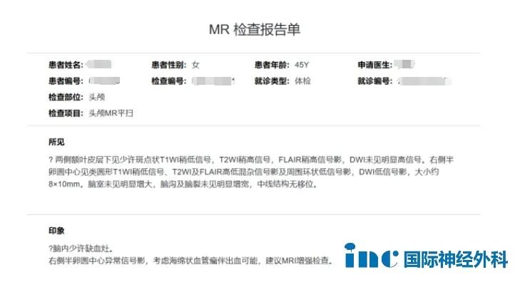 MR檢查報(bào)告單