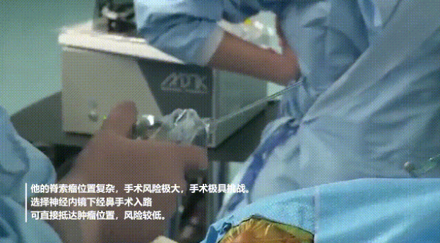 為病人選擇了神經(jīng)內(nèi)鏡下經(jīng)鼻手術(shù)入路可直接抵達(dá)腫瘤位置，風(fēng)險(xiǎn)較低。