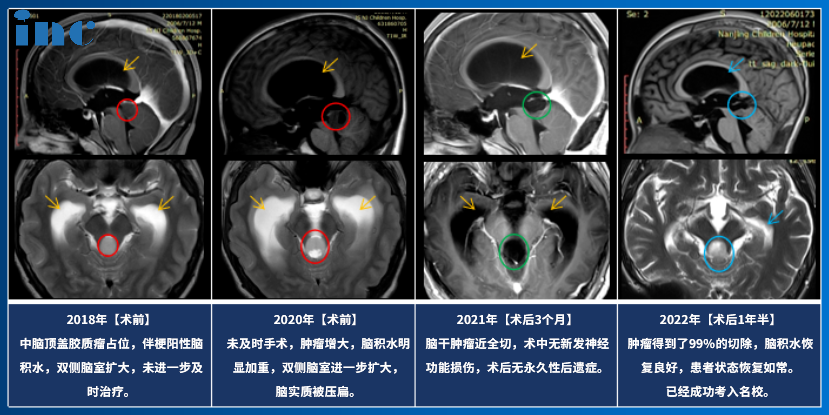 點擊術(shù)前影像，閱讀完整患者故事