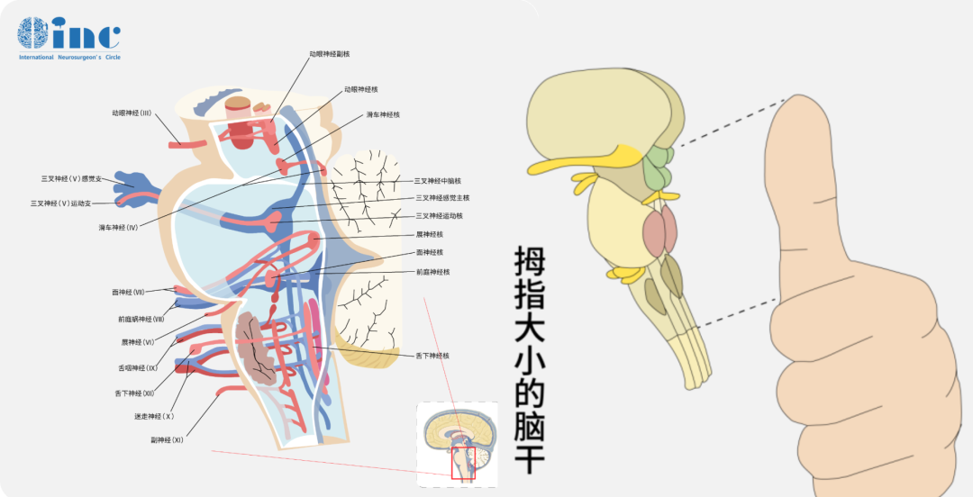 腦干是人的生命中樞，包括中腦、腦橋、延髓，腦干海綿狀血管瘤會(huì)導(dǎo)致腦干出血，使病人出現(xiàn)肢體癱瘓、昏迷，甚至危及生命。
