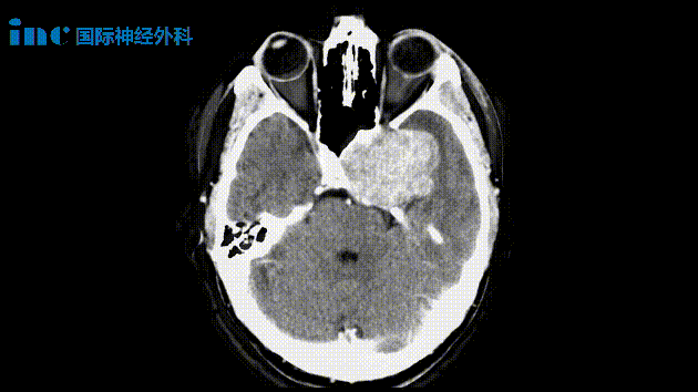 患者術前影像