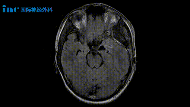 患者術后影像