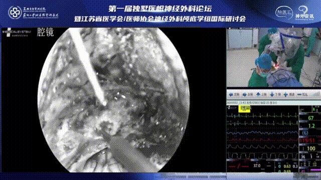 從寰椎后弓側(cè)方進(jìn)行解剖時(shí)要仔細(xì)，采用低功率燒灼參數(shù)，手術(shù)操作要仔細(xì)，避免造成動(dòng)脈損傷及刺破硬腦膜或在分離肌肉時(shí)損傷椎動(dòng)脈。
