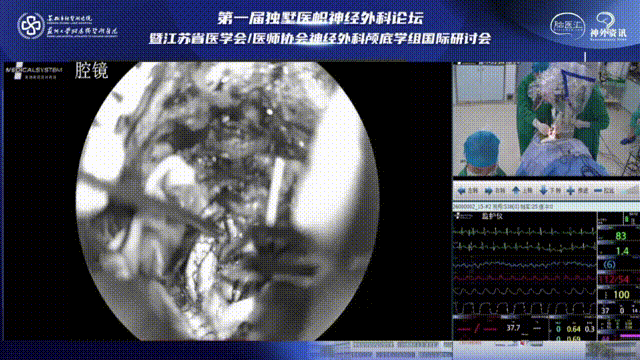 瘤腔、術(shù)野止血，水密縫合腦膜，關(guān)顱，患者全程呼吸、心跳平穩(wěn)，手術(shù)順利。