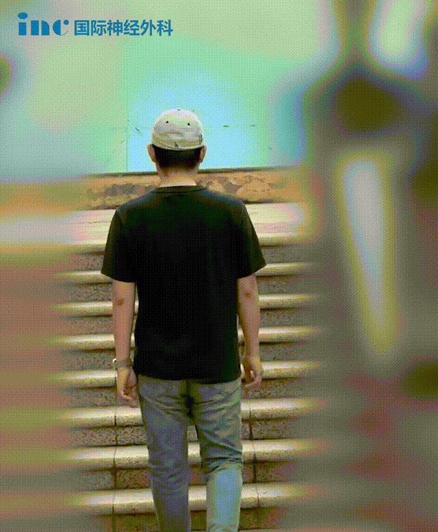 30歲男性-橋腦海綿狀血管瘤