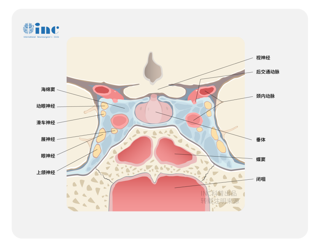 視路膠質(zhì)瘤起源于視神經(jīng)、視交叉、視束或下丘腦等關(guān)鍵部位，這些區(qū)域不僅結(jié)構(gòu)復(fù)雜，而且富含神經(jīng)纖維和血管。