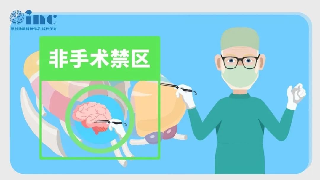 James T. Rutka教授尤其擅長兒童丘腦膠質(zhì)瘤患者的個(gè)性化綜合治療，在他看來，丘腦不再是手術(shù)的“禁區(qū)”，而是需要勇氣和能力的“戰(zhàn)區(qū)”。