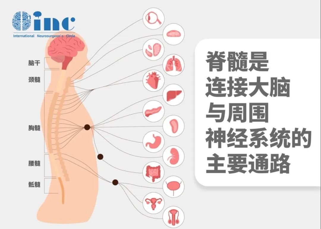 通俗來說，如果小腦扁桃體進(jìn)入頸椎管內(nèi)，就會造成擁擠，類似于公路上的堵車甚至撞車，導(dǎo)致患者因脊髓神經(jīng)壓迫和腦脊液循環(huán)不暢，出現(xiàn)壓迫癥狀和脊髓空洞。