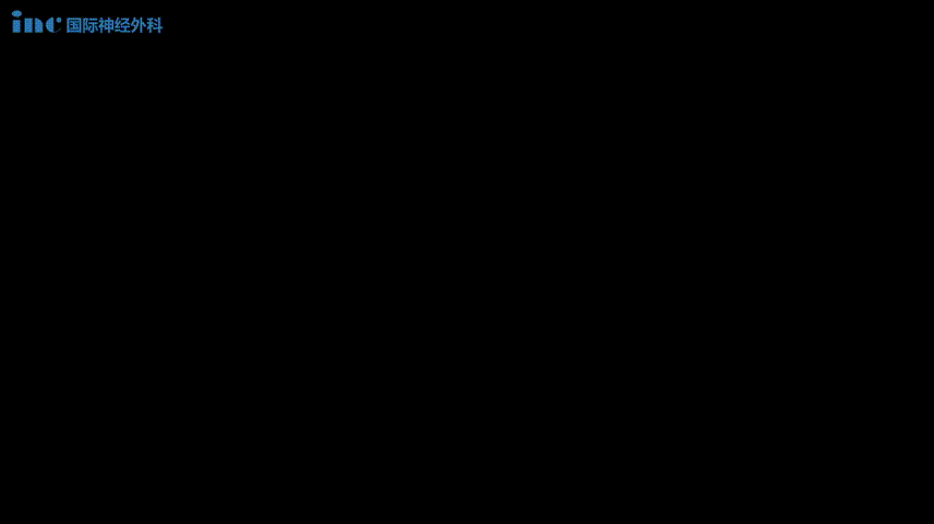 大手拉小手，術(shù)后，巴爺爺和小杰一起做起了康復(fù)“小游戲”。