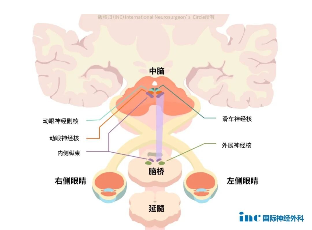 INC巴教授主刀、國(guó)內(nèi)神經(jīng)外科醫(yī)生團(tuán)隊(duì)全力配合下，突破“生命禁區(qū)”，為她順利示范手術(shù)。