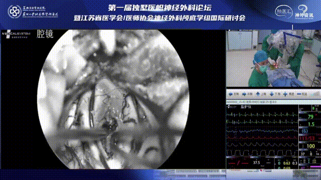 在脊髓對(duì)側(cè)病灶浸潤(rùn)突破延髓表面處做切口、鈍性分離，使用由上至下按序逐步分離腫瘤和腦組織，避免過(guò)分牽拉脊髓造成神經(jīng)損傷。