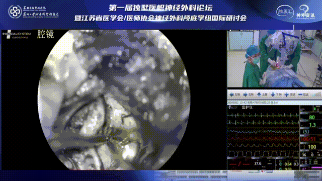 繼續(xù)分離腫瘤和腦組織，注意避免出血，在切除病變過(guò)程中注意鈍性分離、避免使用雙極電凝損傷脊髓。