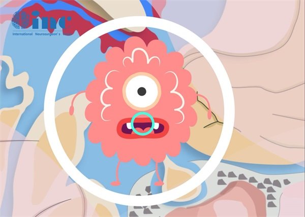 大腦半球腦血管畸形是什么病?
