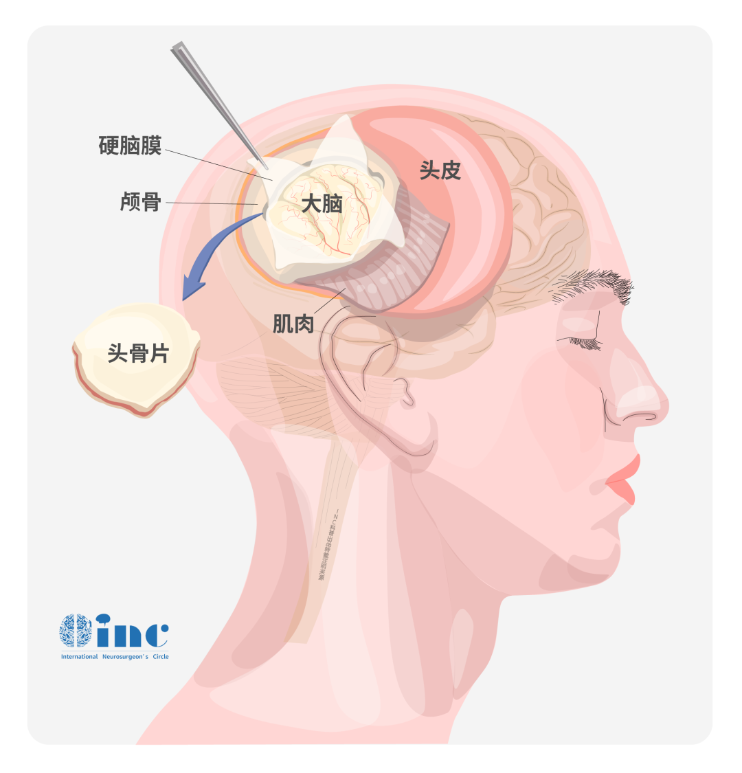 腦膜