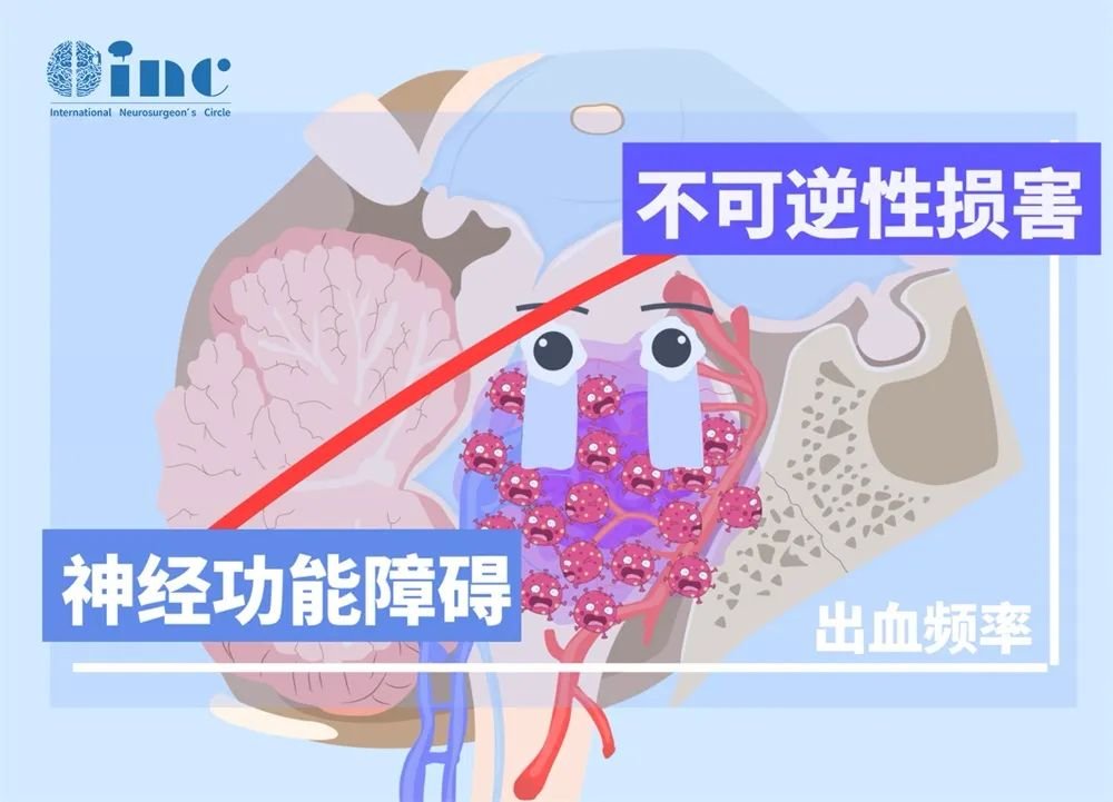 但是等待，正如有時(shí)會(huì)被許多醫(yī)生推薦的那樣，并不好，因?yàn)榻?jīng)過長期的等待，在最初的一次出血之后，會(huì)形成一個(gè)局部疤痕，而這個(gè)疤痕的形成實(shí)際上阻礙了一個(gè)好的手術(shù)，這使得手術(shù)更困難，更危險(xiǎn)，甚至有時(shí)阻礙完全切除病變。